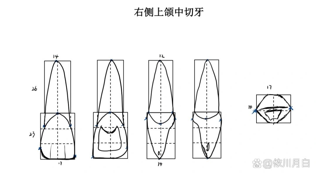 上颌中切牙3倍大画图图片