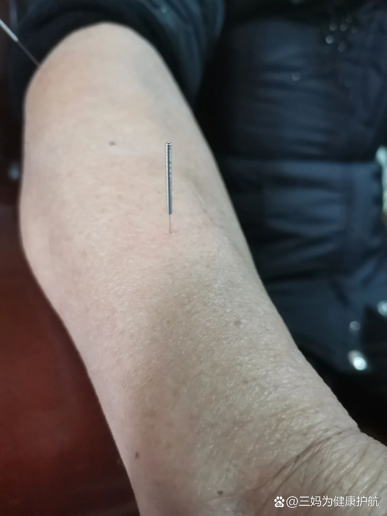 支沟,照海,治疗便秘