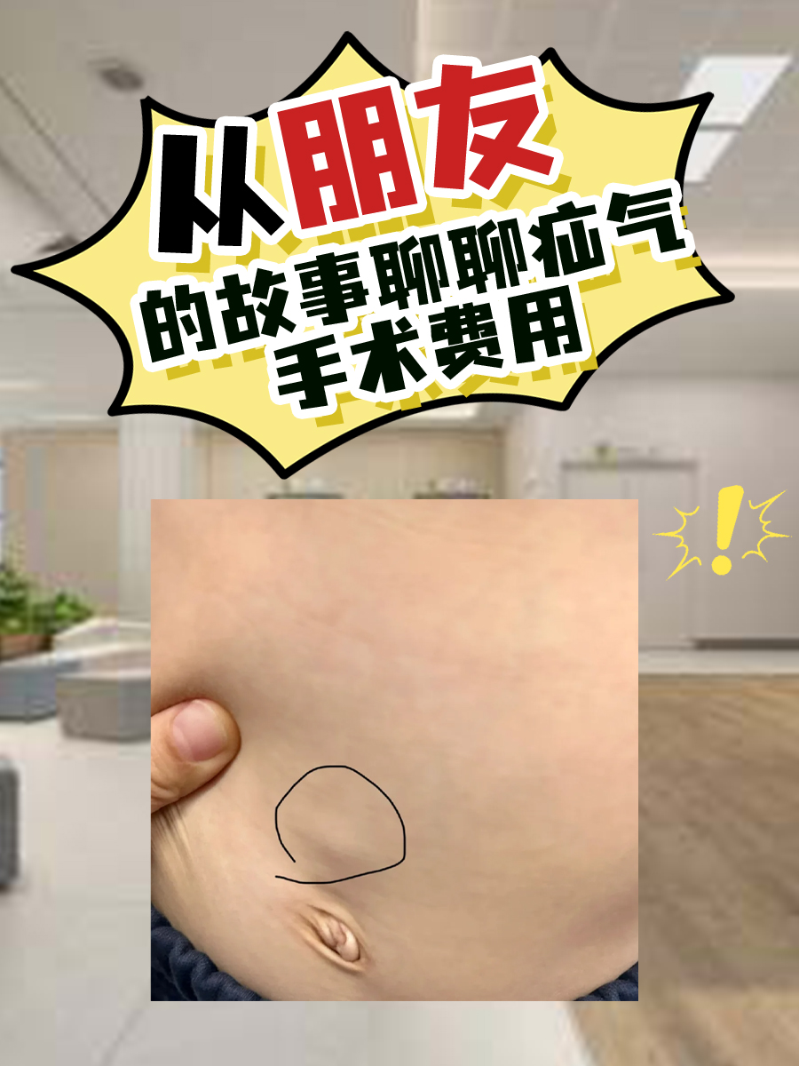 从朋友的故事聊聊疝气手术费用