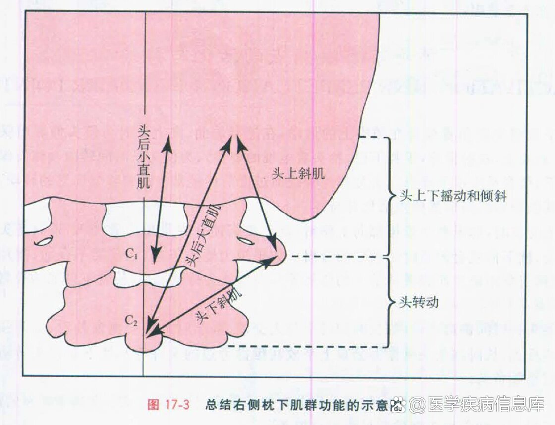 26.枕下肌群头后大,小直肌,头上,下斜肌解剖