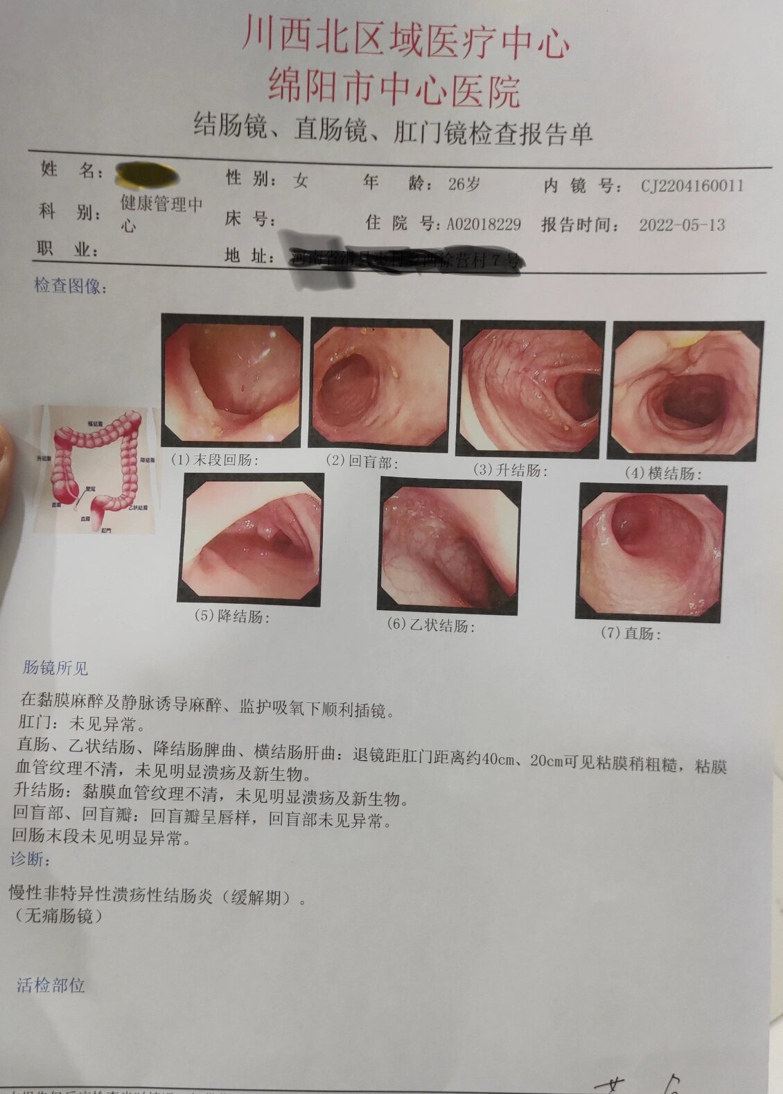 肠粘膜脱落后会自愈吗图片