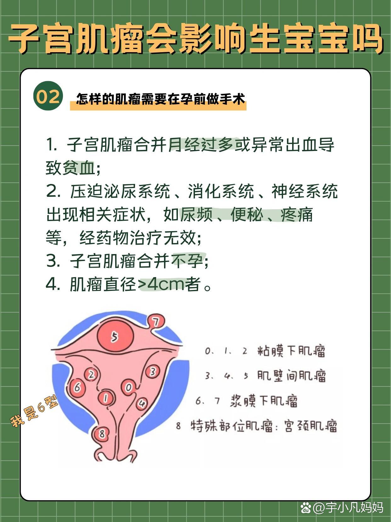 怀孕期间发现有子宫肌瘤!