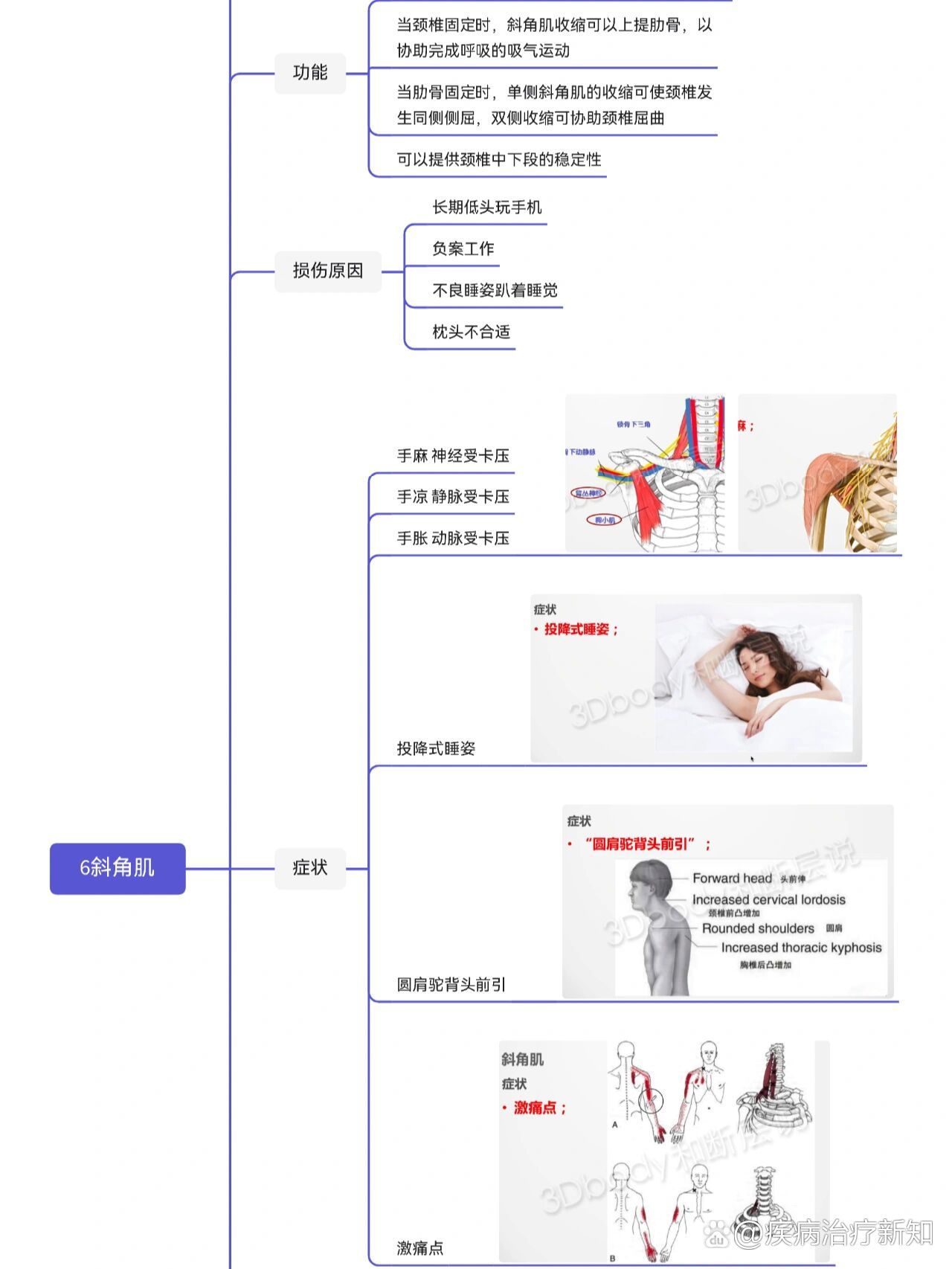 颈椎病最重要的肌肉-斜角肌