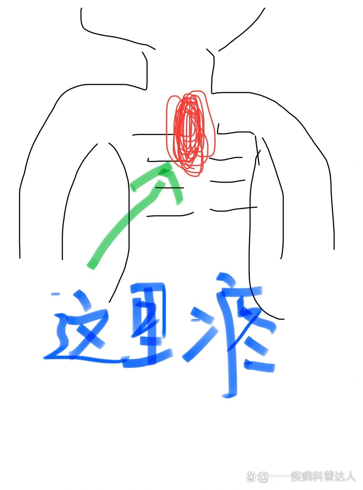 左肋疼痛位置图图片图片