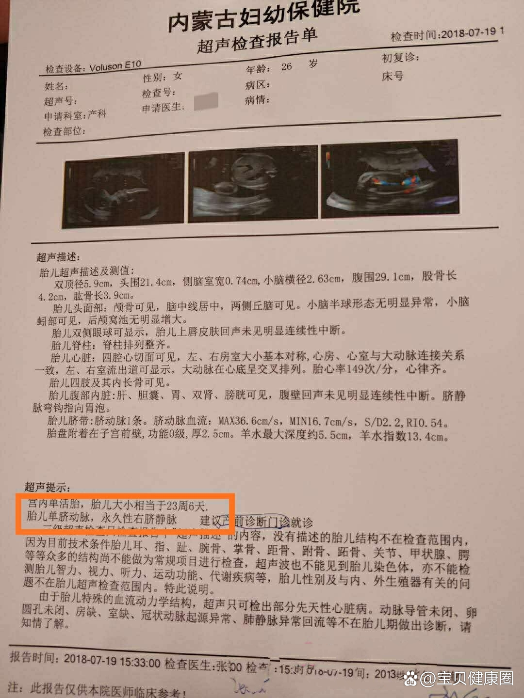 单脐动脉不要慌,真实经历分享