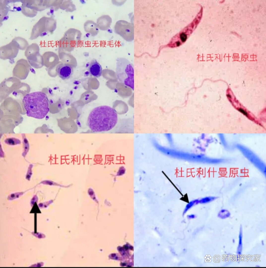 杜氏利什曼原虫利杜体图片