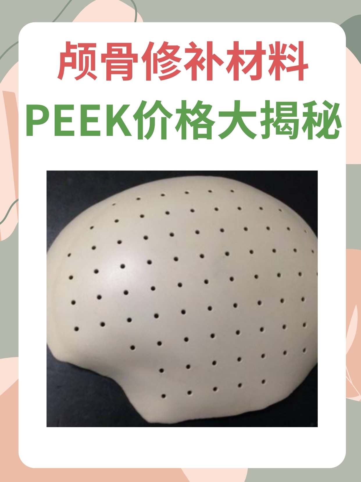 颅骨修补材料peek价格大揭秘