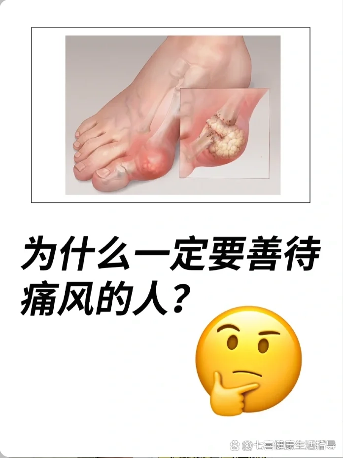 高尿酸警告⚠症状自查 保养攻略