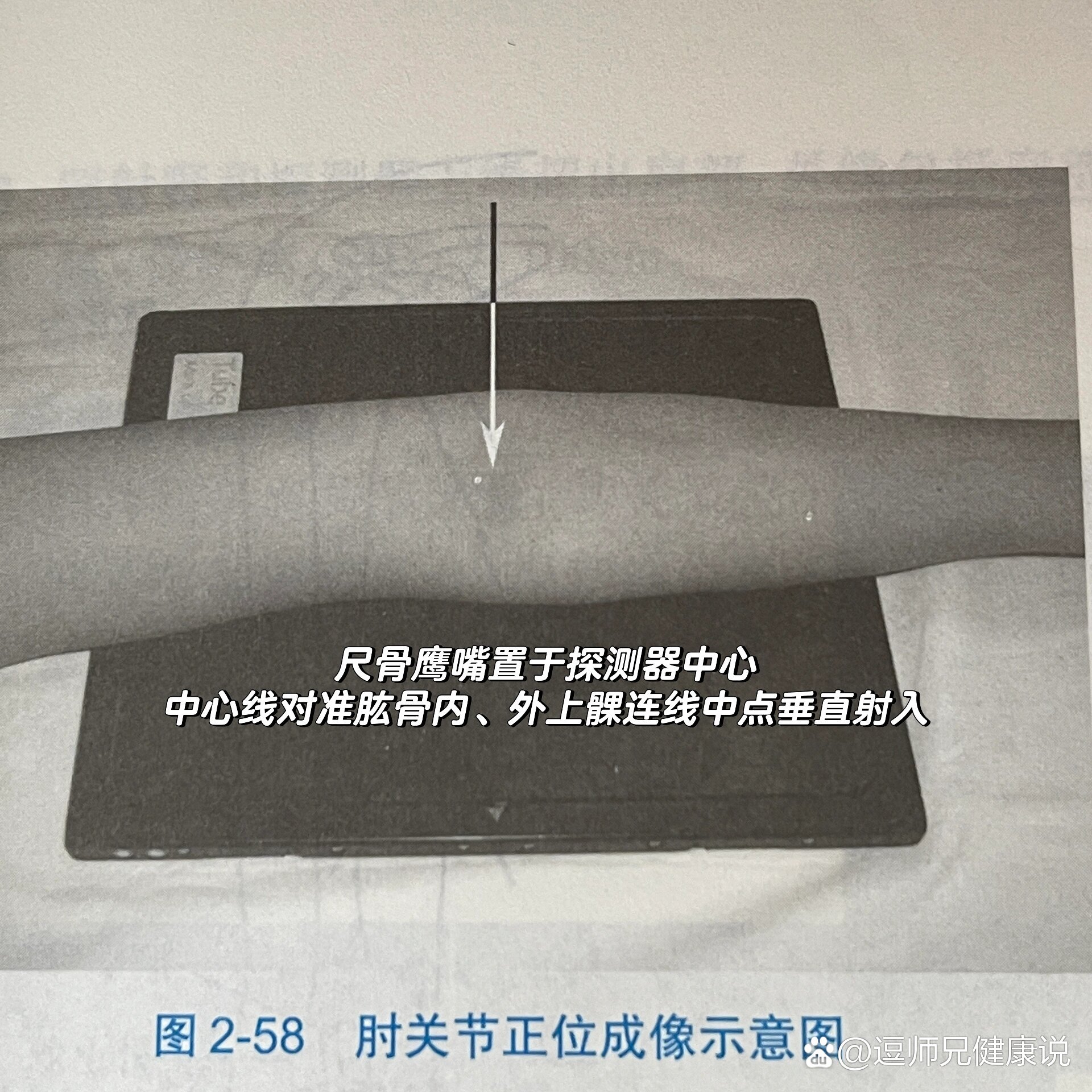 肘关节正位&侧位