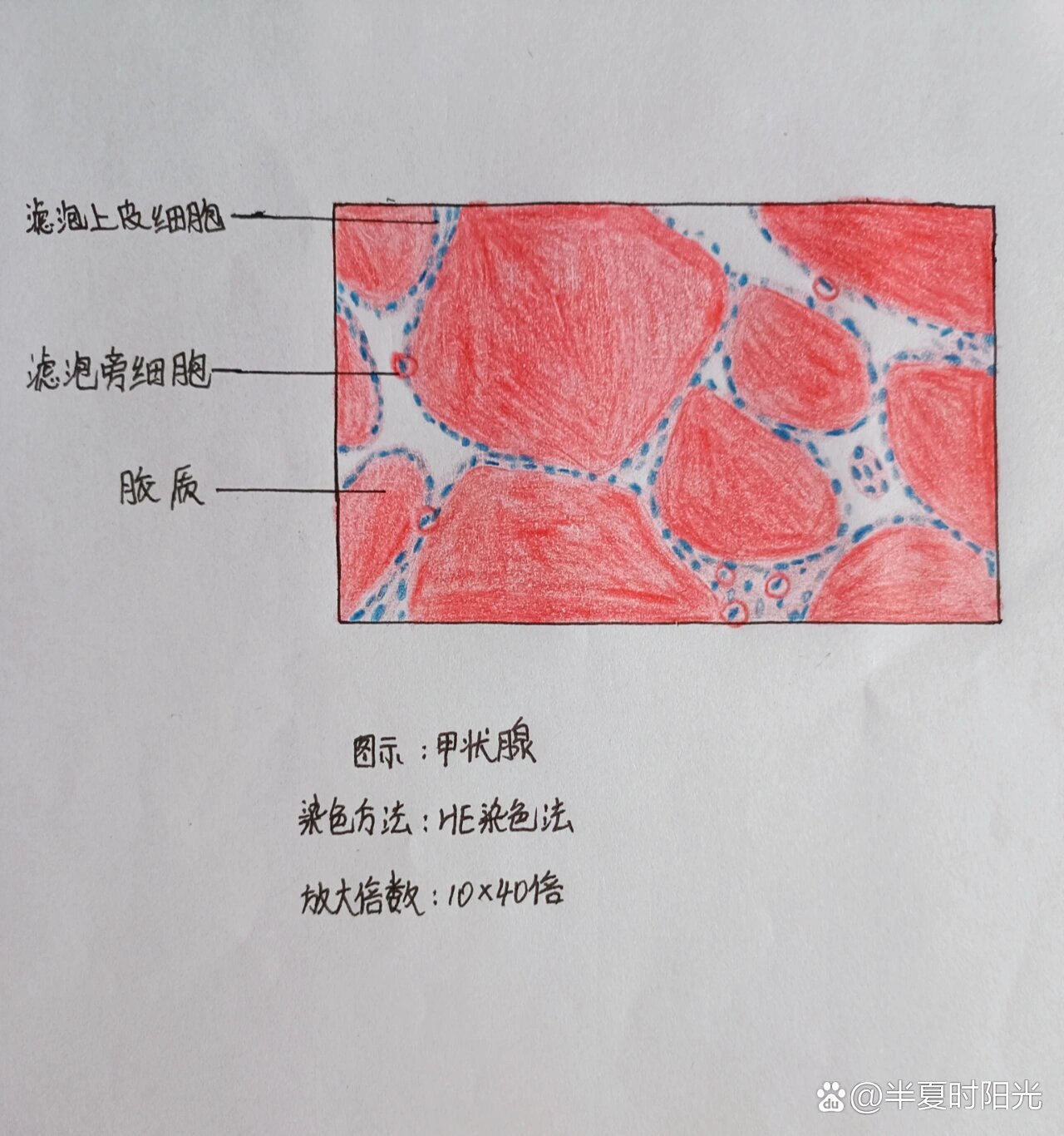 甲状腺切片手绘图图片