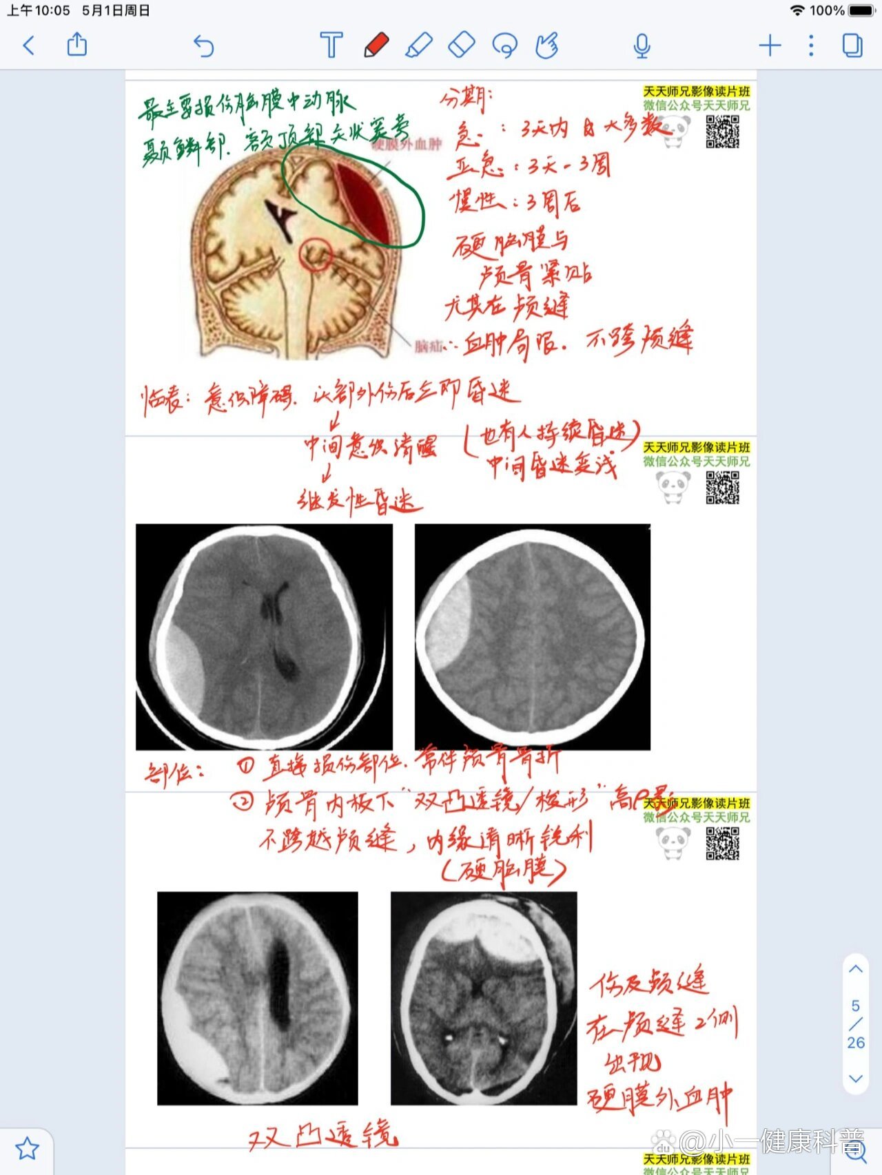 医学影像学片子图片