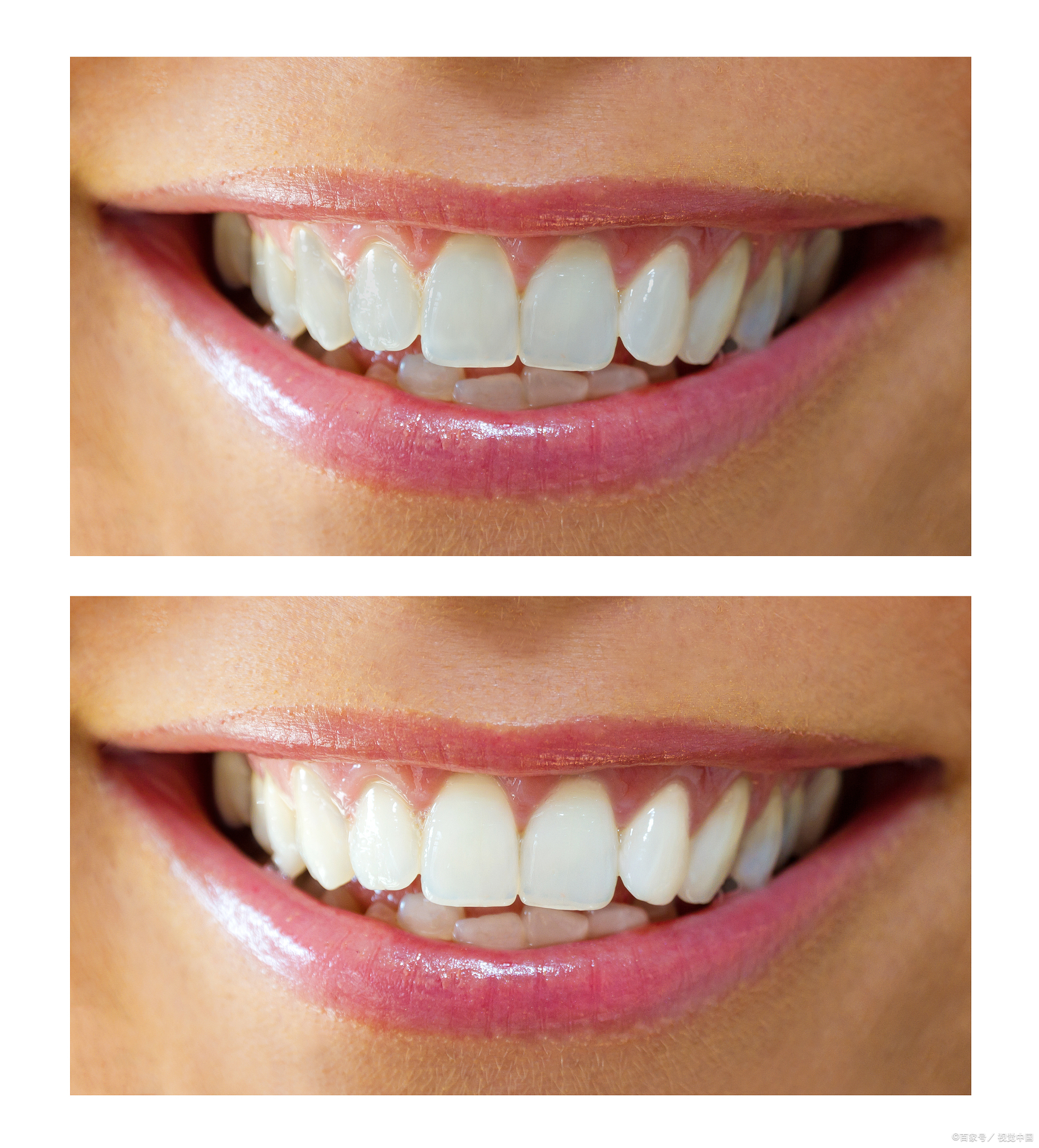 有一次性美白牙齿的东西吗?美白牙贴或许可以了解一下!