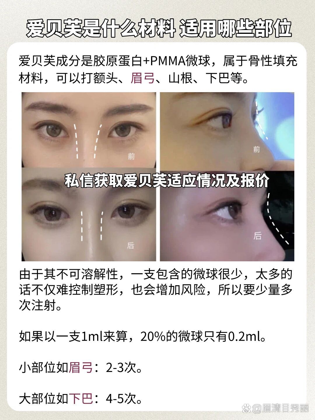 爱贝芙是什么材料?