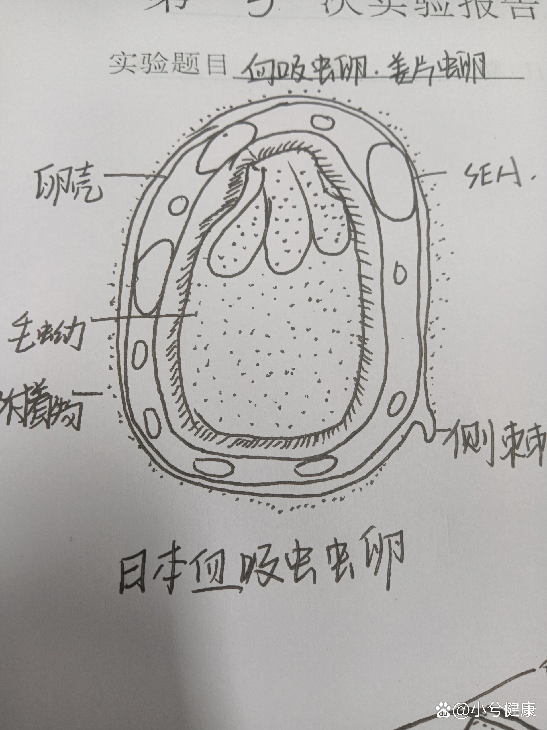 虫卵大全图解图片