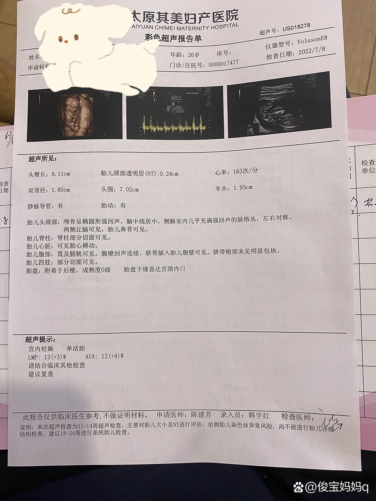 头臀径12周图片