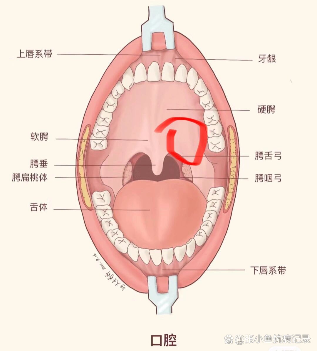 嘴巴上颚肿痛