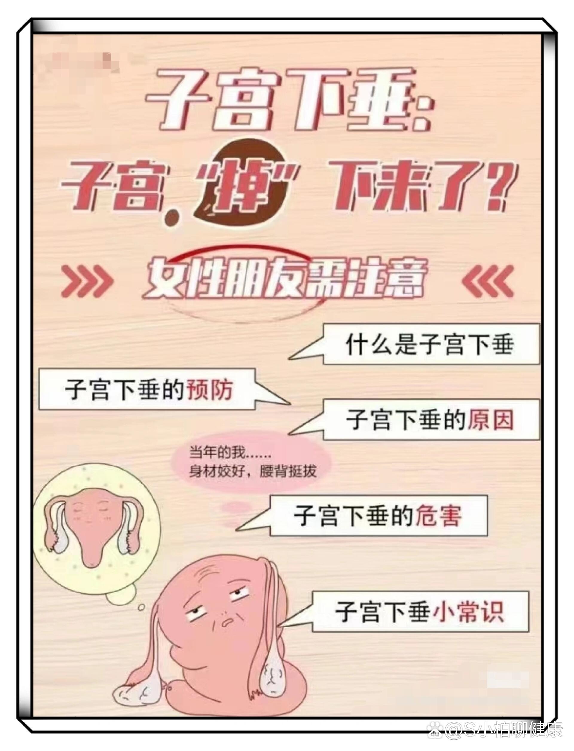 子宫下垂有什么症状图片