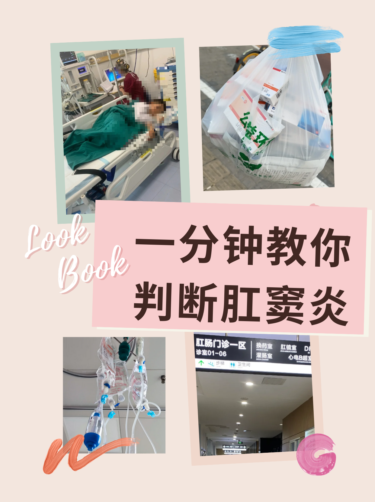 一分钟教你判断肛窦炎