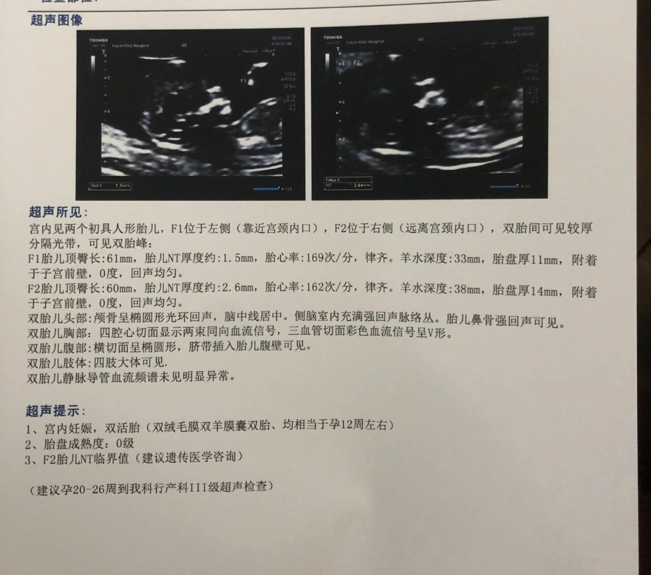 怀孕12周双胞胎图片图片