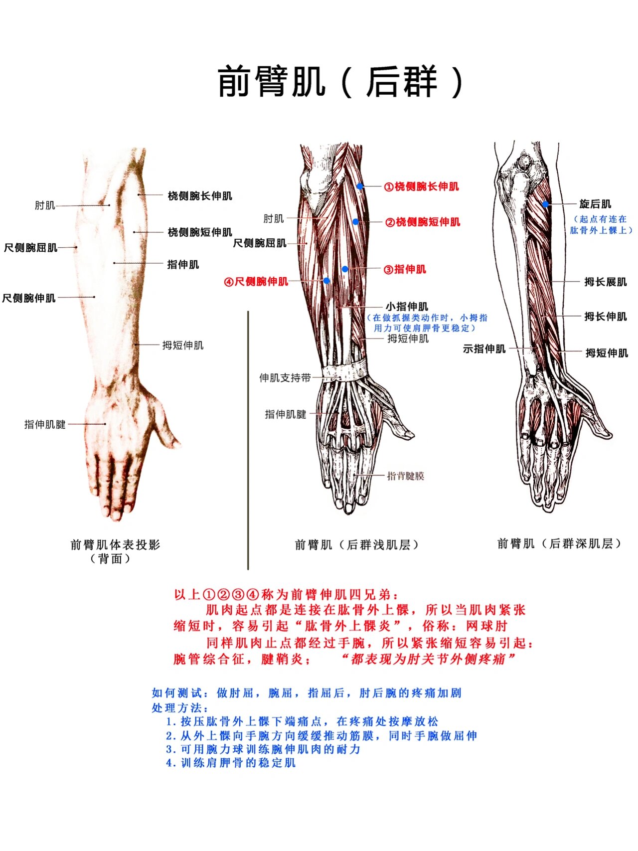 腕伸肌腱鞘炎图片