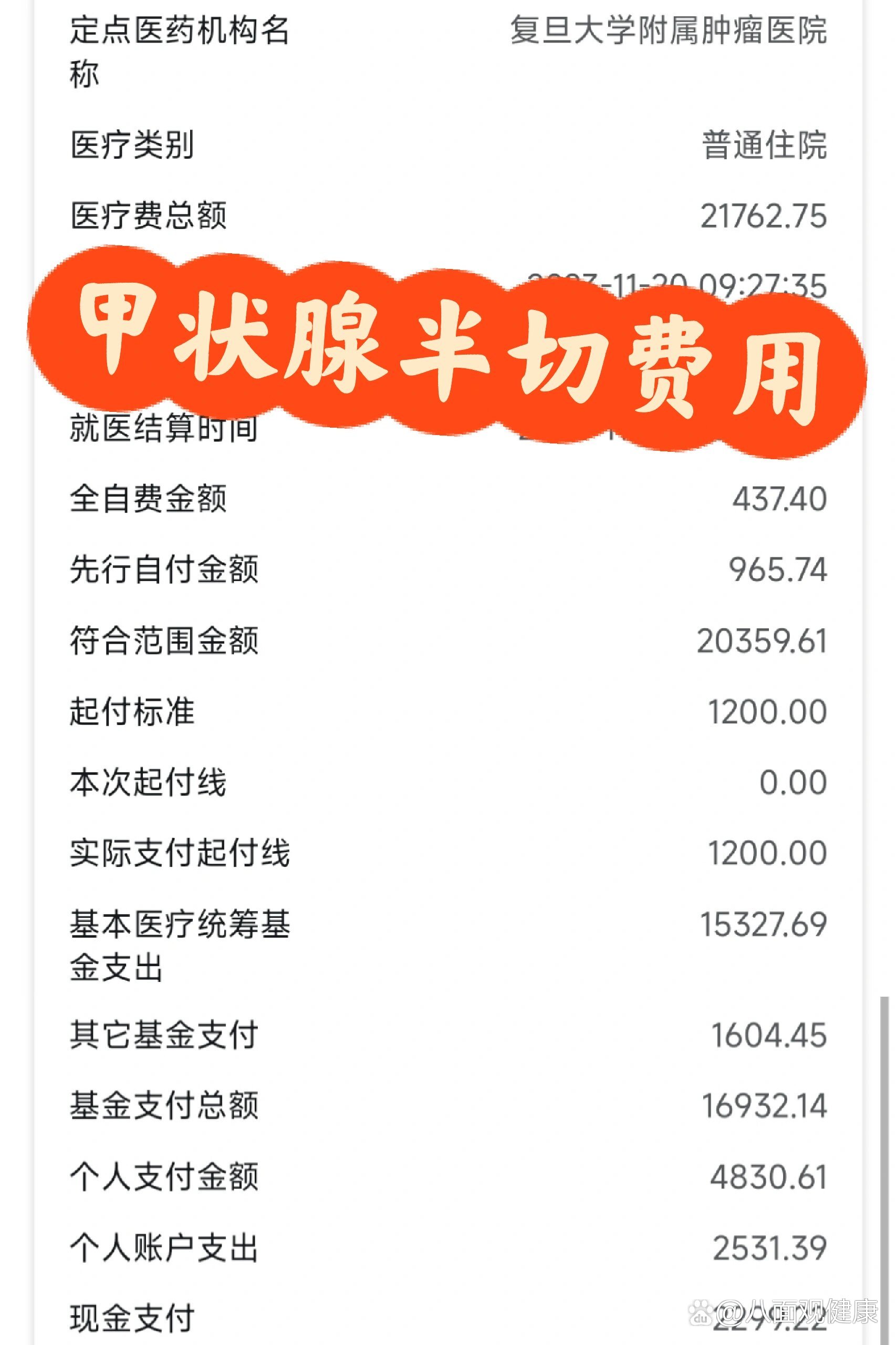 丽水最新的医院报销80%计算公式方法分享(丽水医院报销80%怎么算教程)