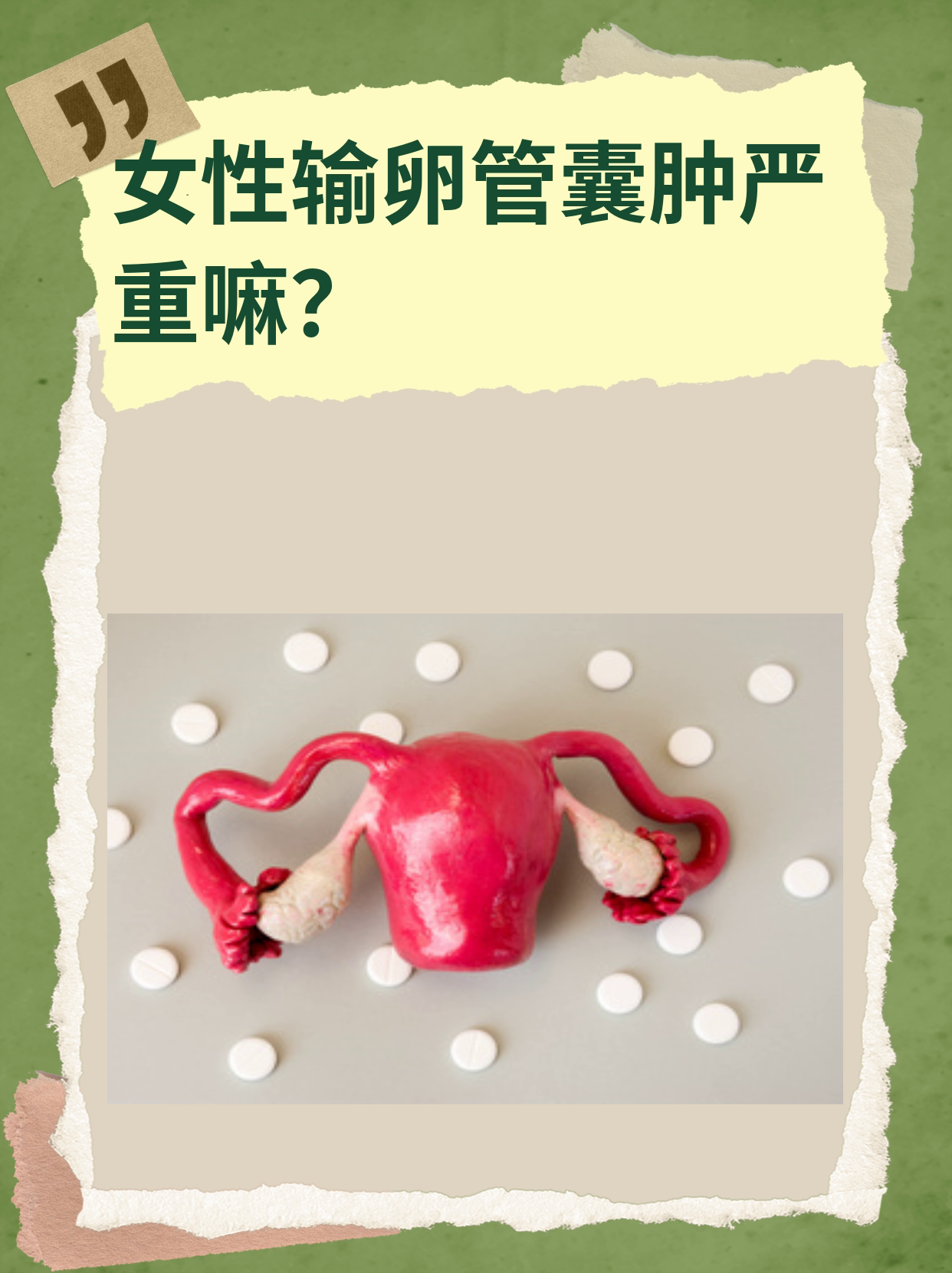 女性输卵管囊肿严重嘛