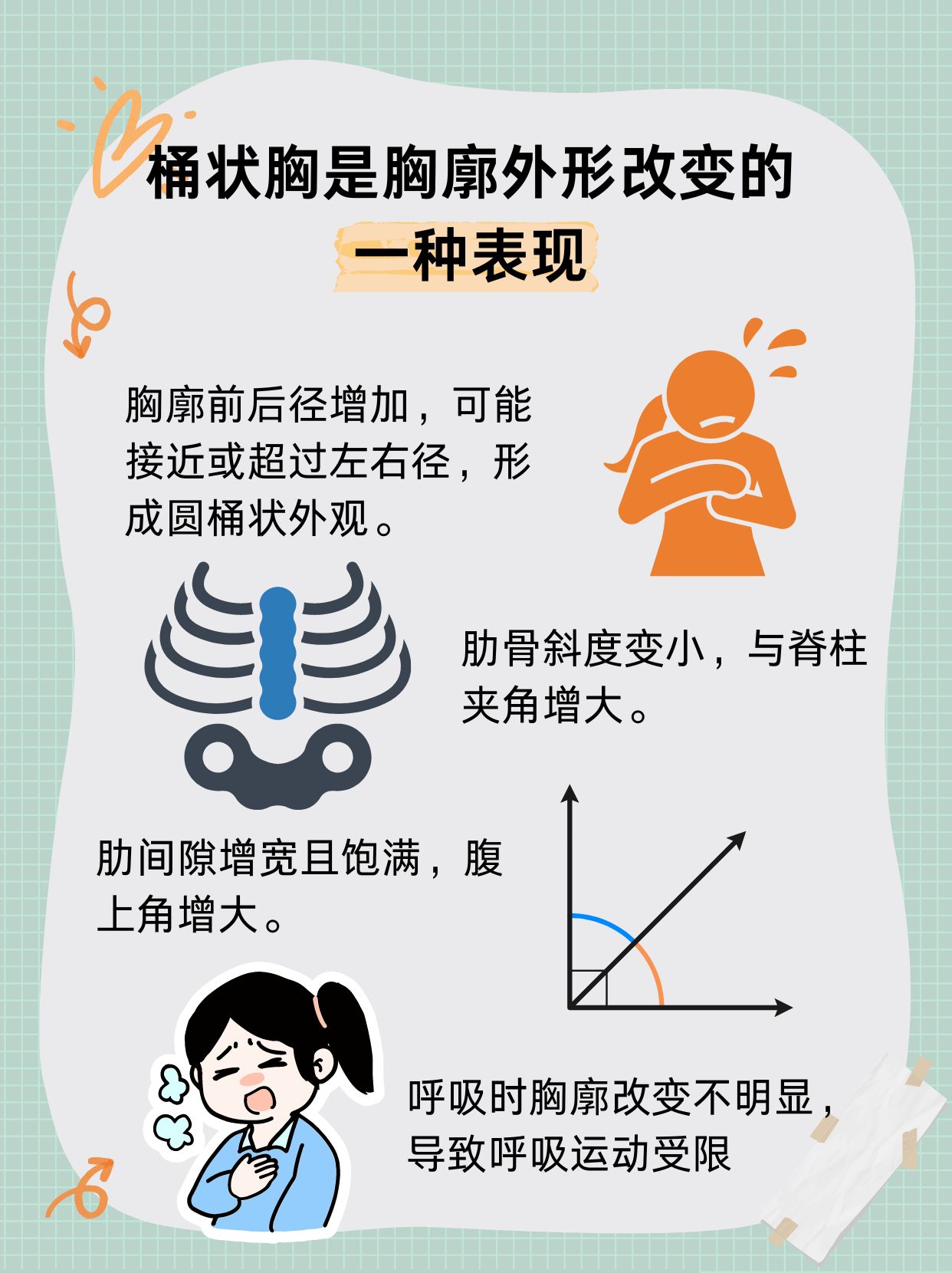 桶状胸来袭!了解这个怪病真面目!