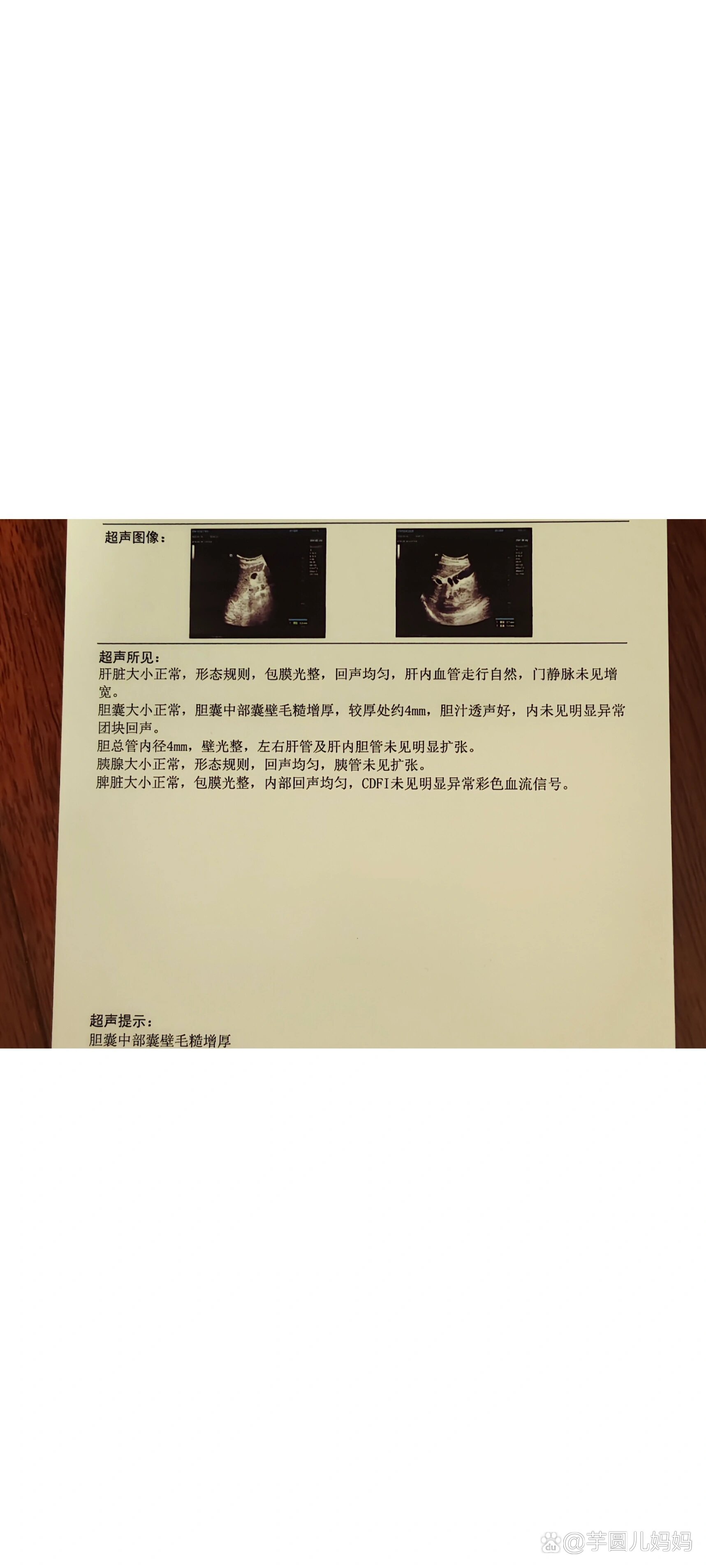医院复查了一下,今年正好遇到市里的超声医生下来帮我b超说局部增厚