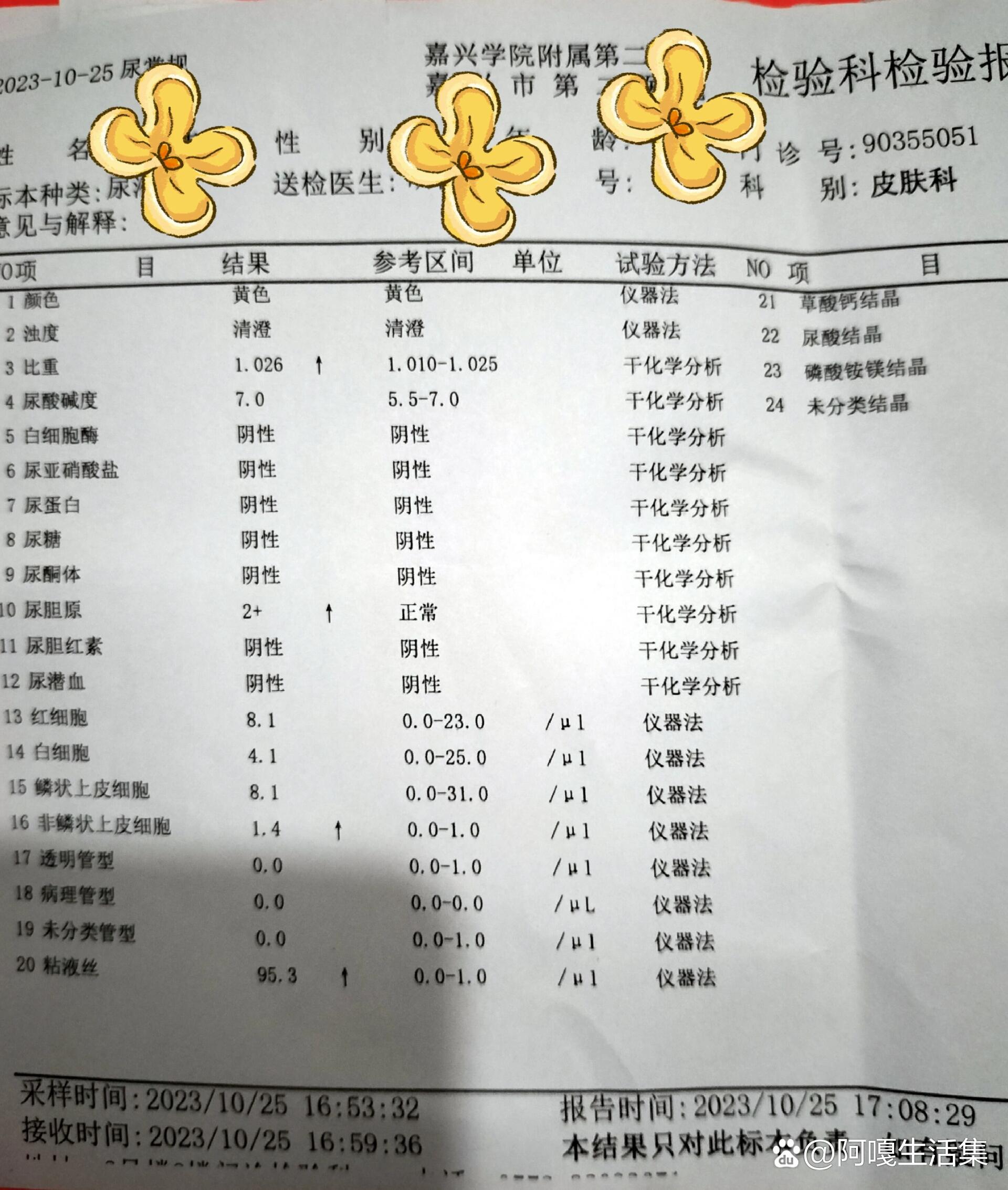友友们,粘液丝95.3是什么意思?