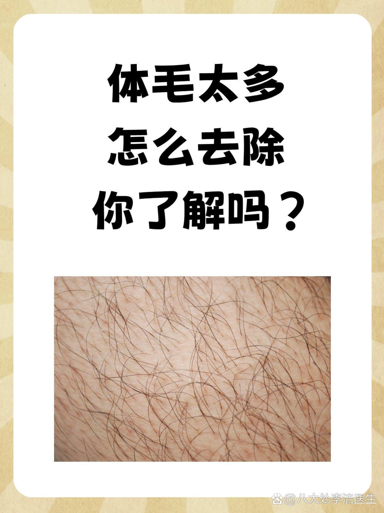 体毛太多怎么去除，你了解吗？