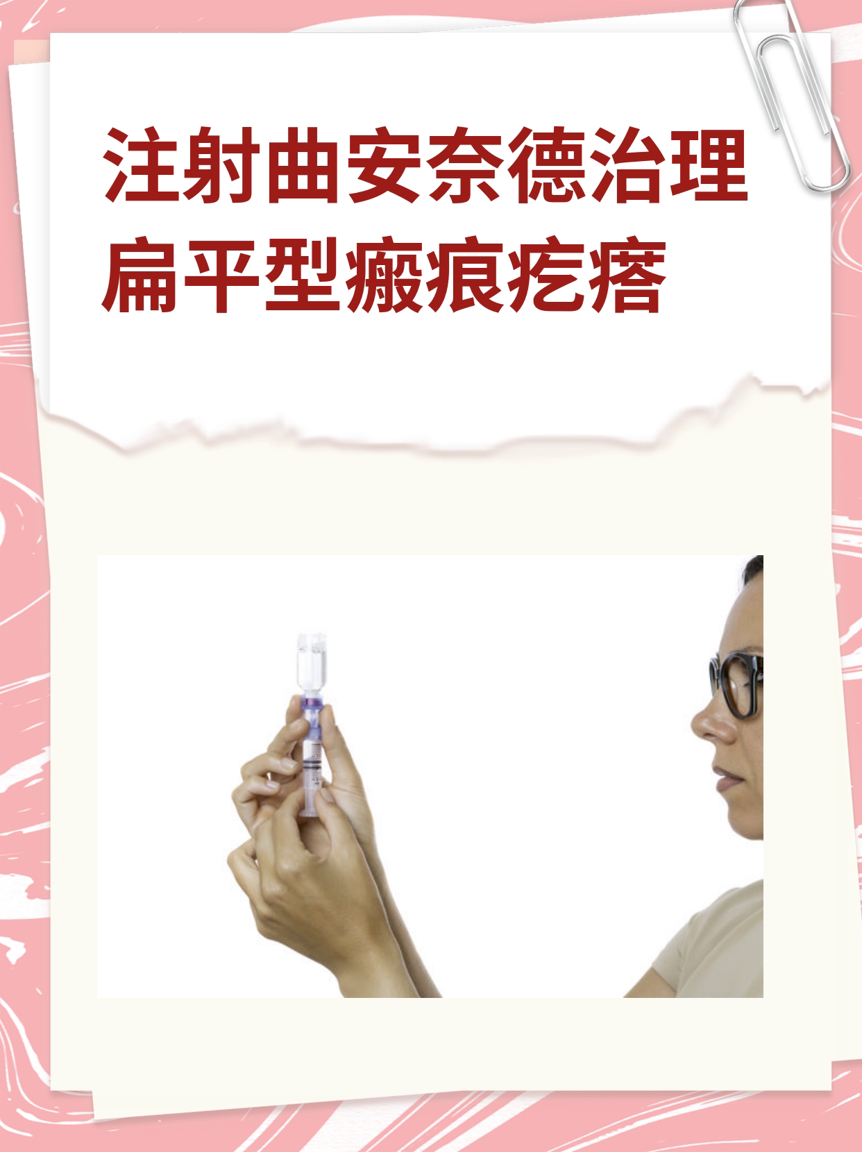 注射曲安奈德治理扁平型瘢痕疙瘩
