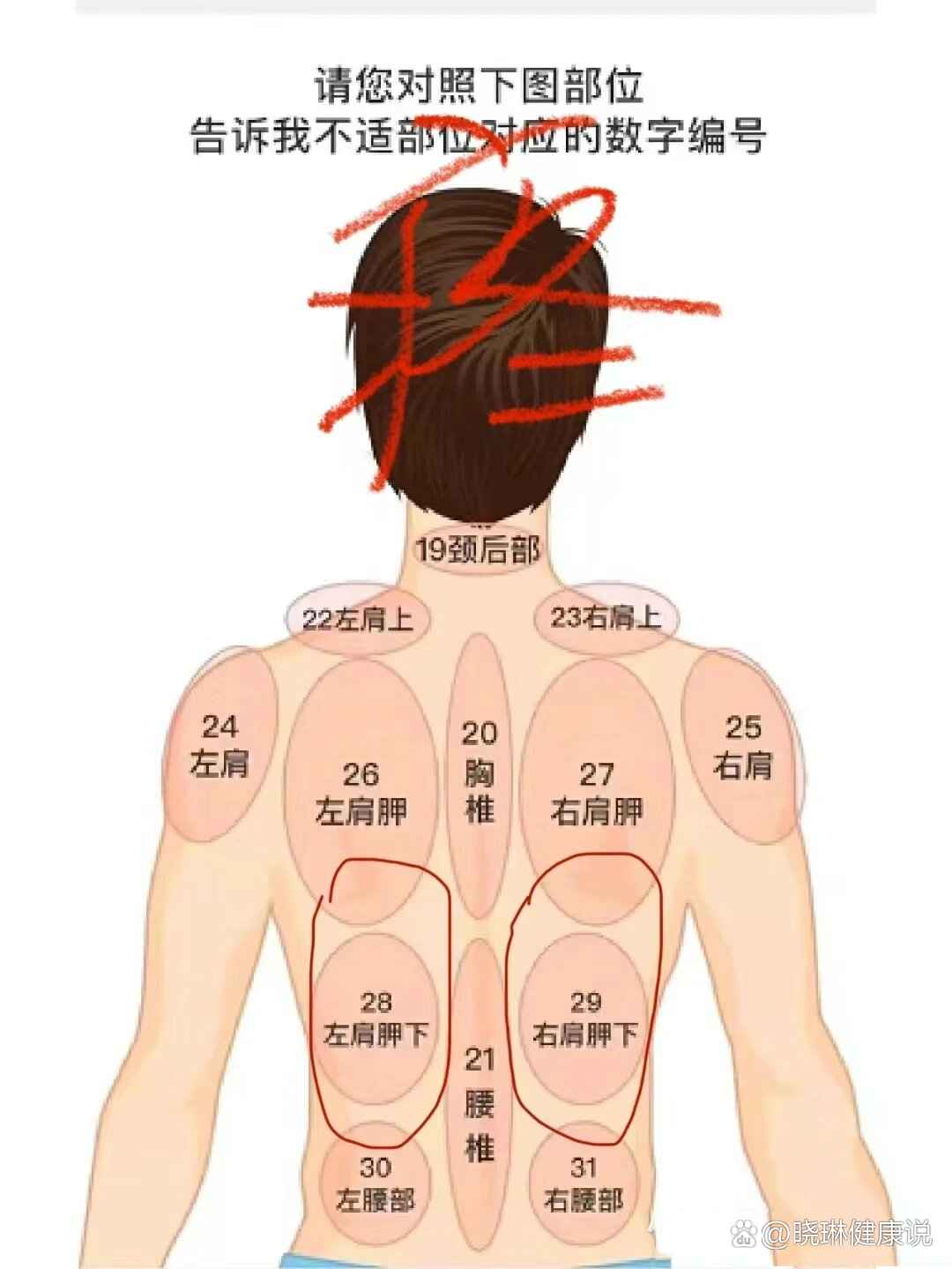 后背部位疼痛图解图片