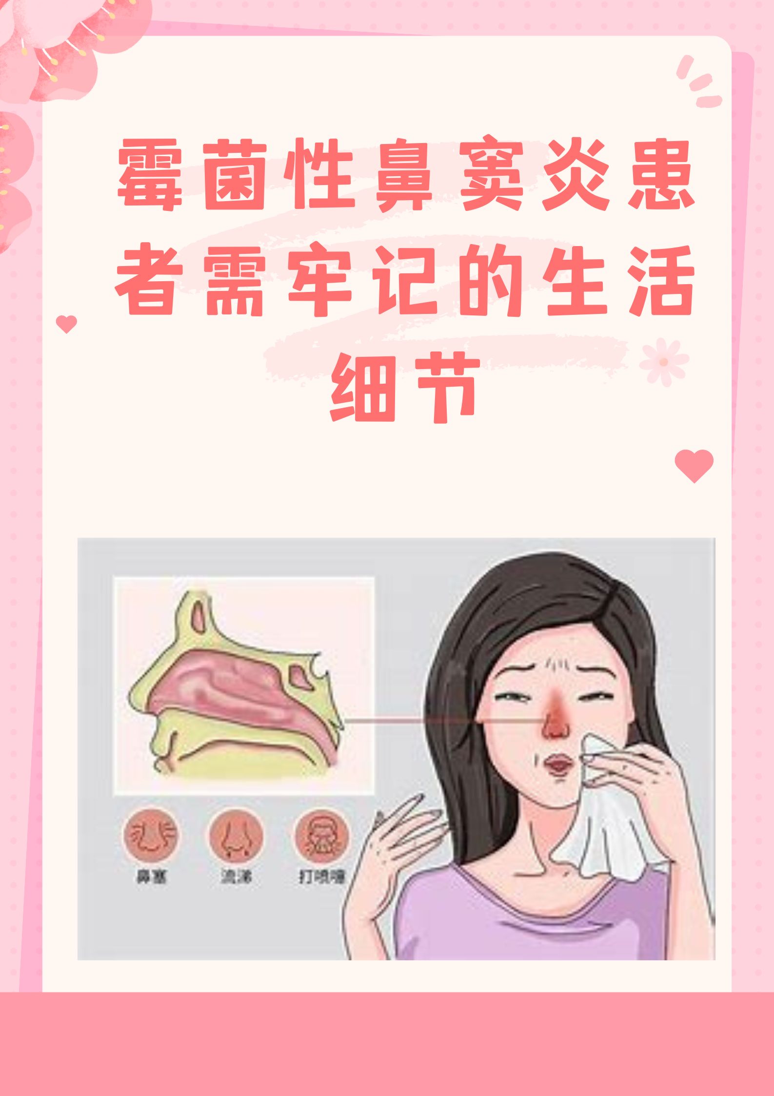 如何有效治疗霉菌性鼻窦炎?最佳方法大揭秘