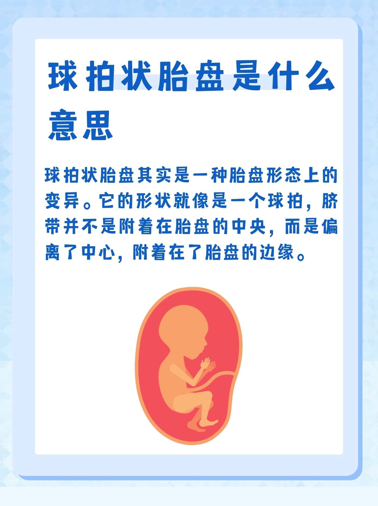 球拍状胎盘孕期知识小科普