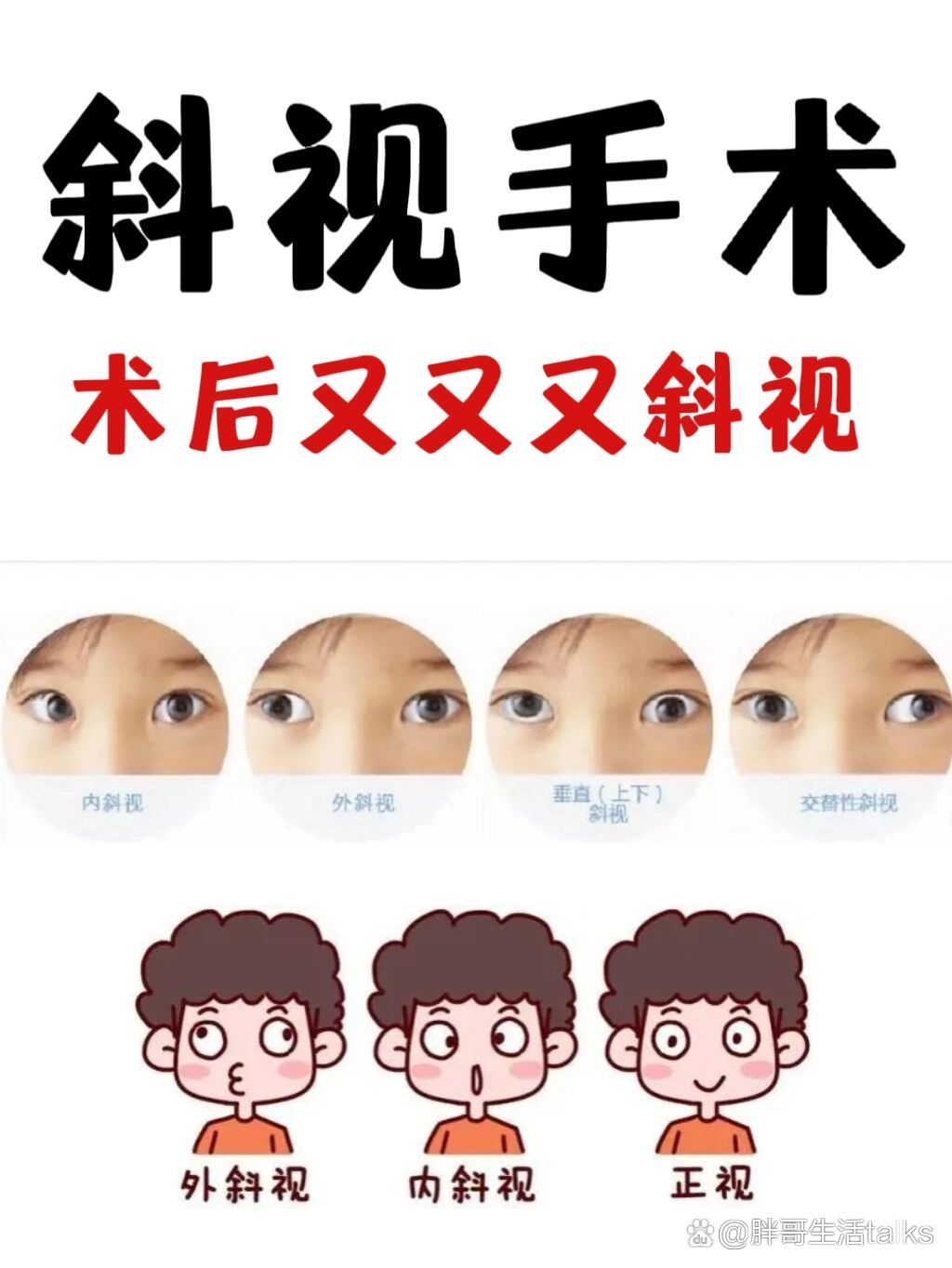 西安-斜视手术后又斜视的原因和治疗方向