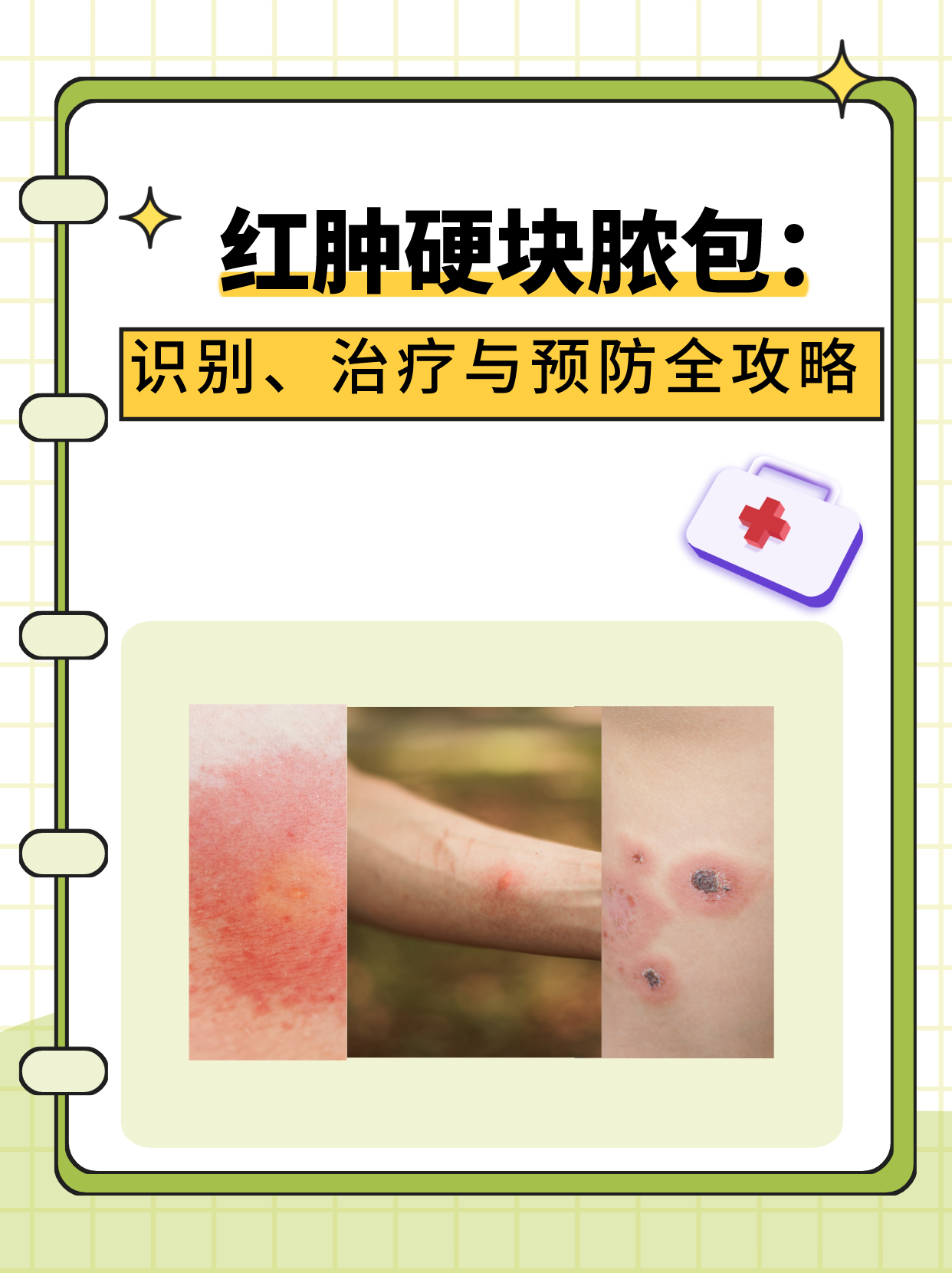 红肿硬块脓包:识别,治疗与预防全攻略