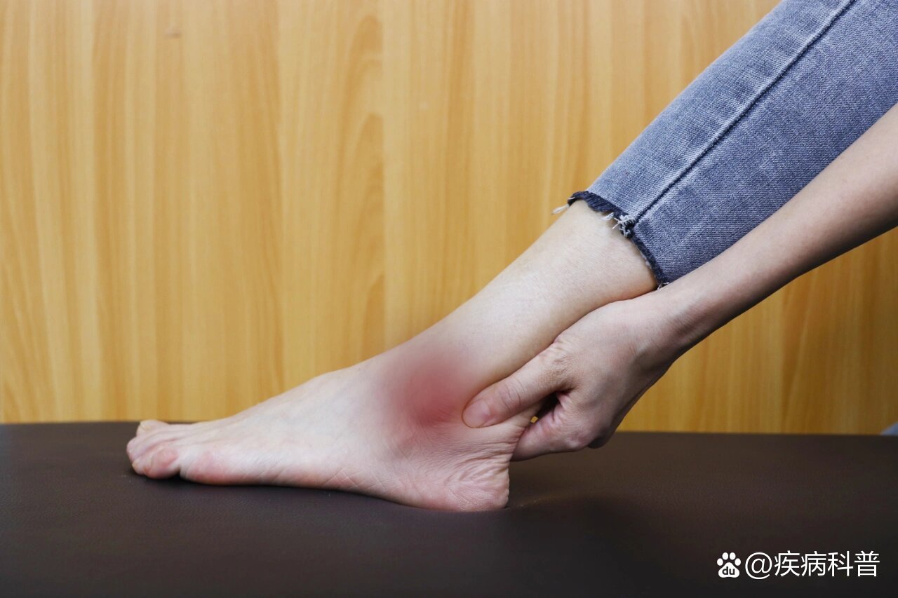  p>脚扭伤后06在家正确处理的方法 br>脚扭伤后应冰敷,而非热敷,擦