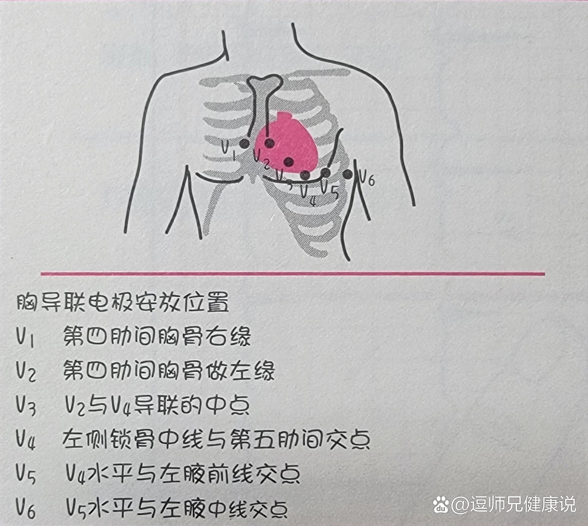 心电图5个电极位置图图片