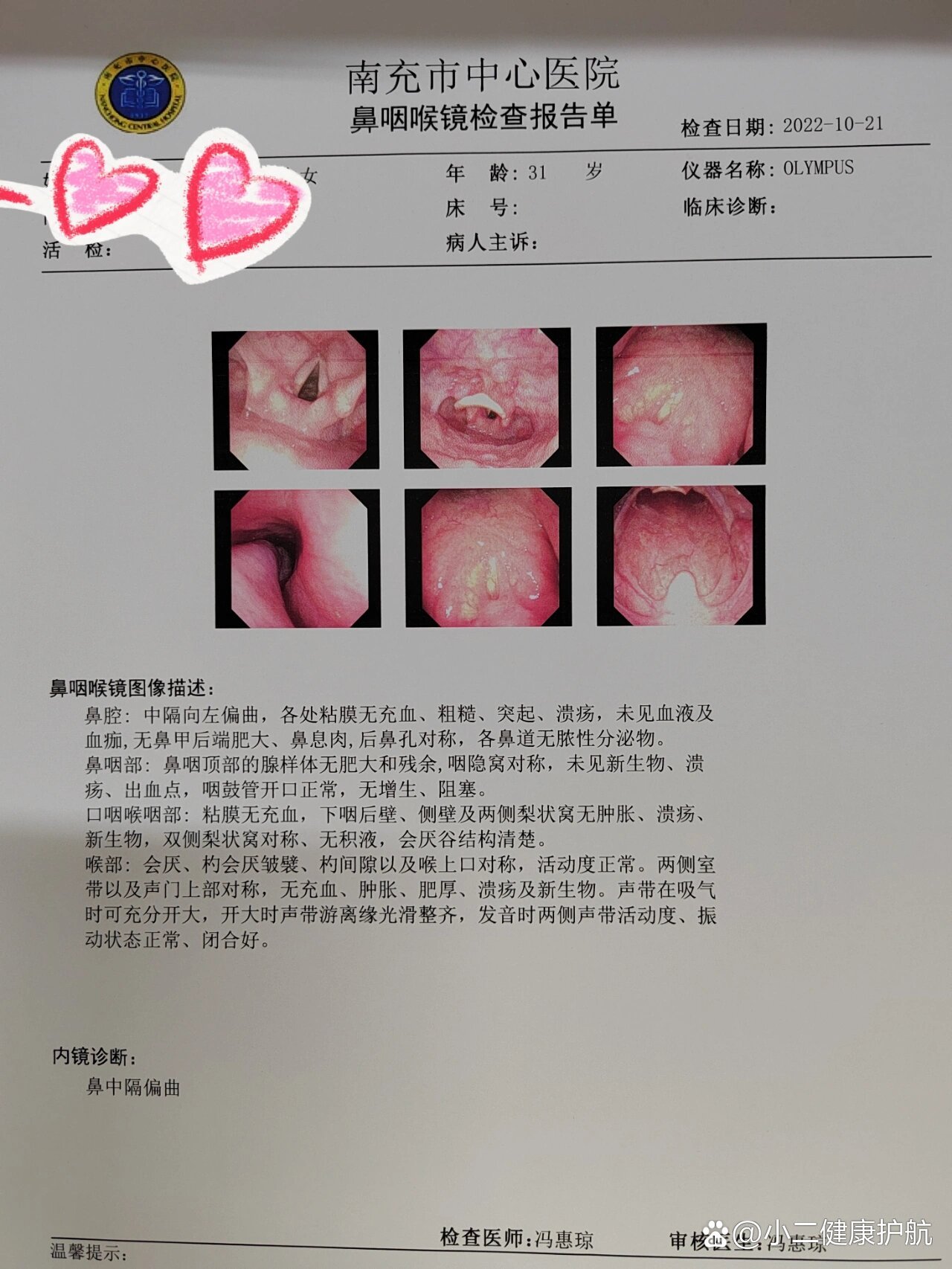  p>从5月开始早上起床反酸带血 先是觉得胃里出血去查胃肠镜 正常 但