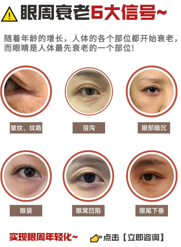 10秒教你自测眼周衰老情况!