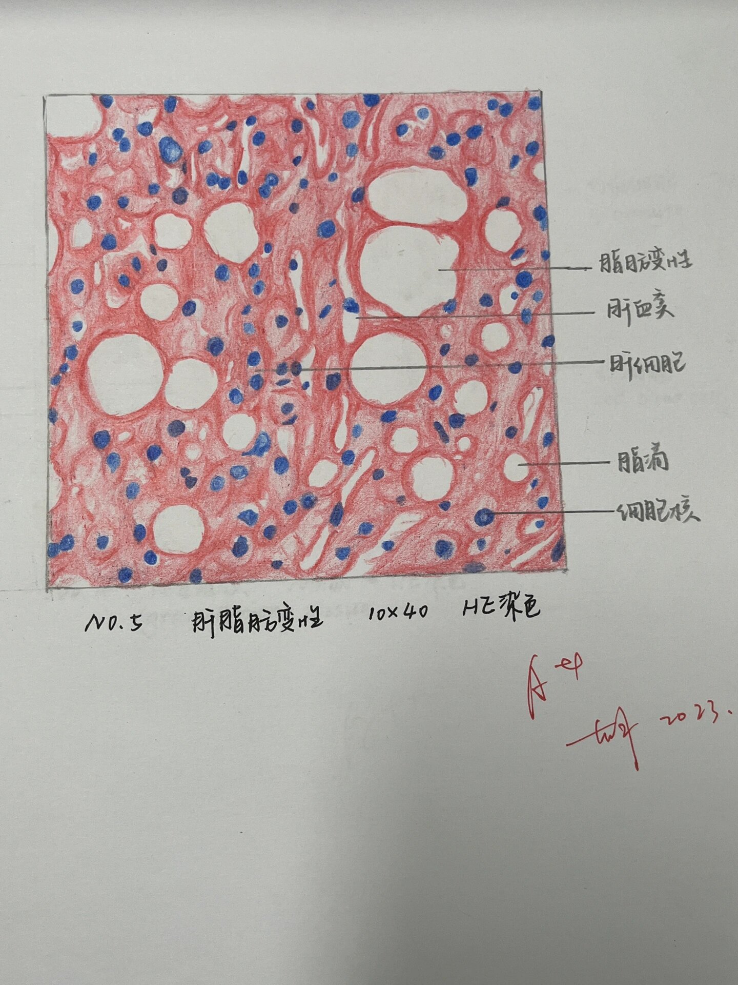 病理红蓝铅笔绘图1⃣️