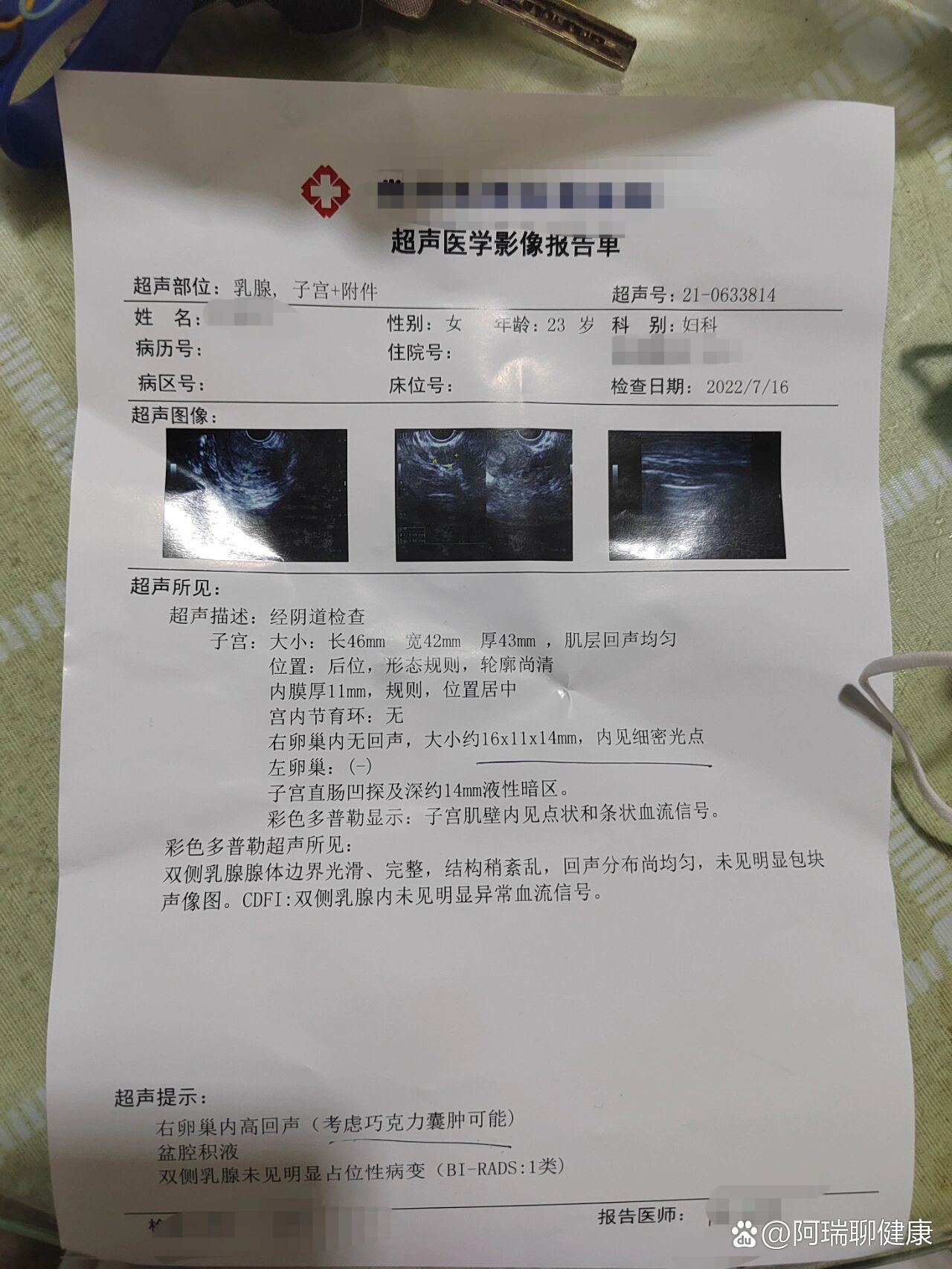 右侧附件囊性包块,生理性,不要怕