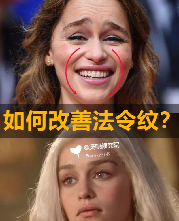 显老又苦相?如何改善法令纹