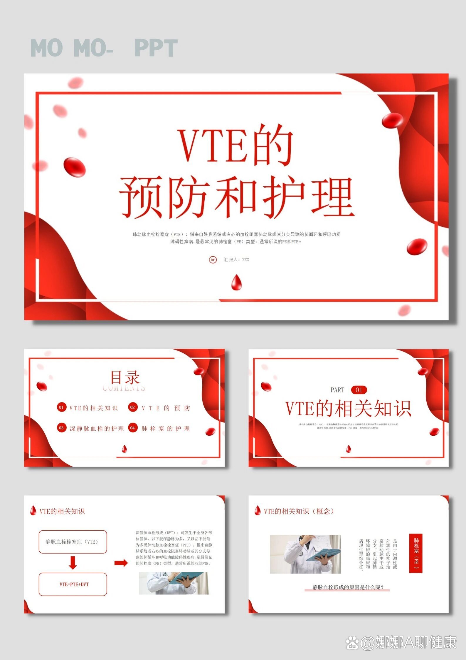 90vte的预防及护理ppt模板【180】