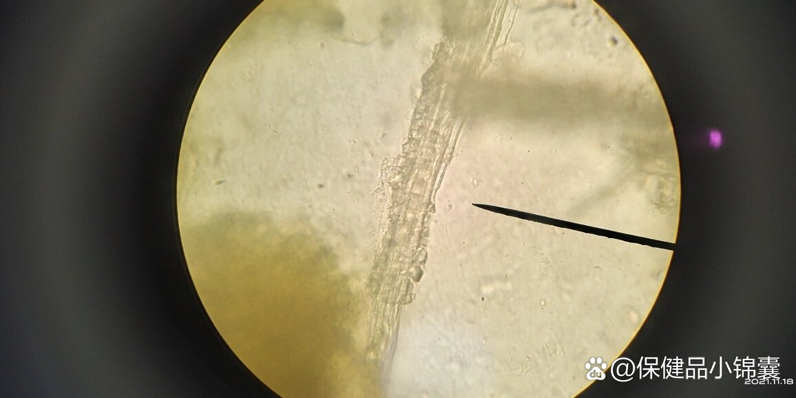  p>番泻叶显微鉴别 br>1.晶纤维 br>2.气孔(平轴式) br>3.非腺毛 /p>