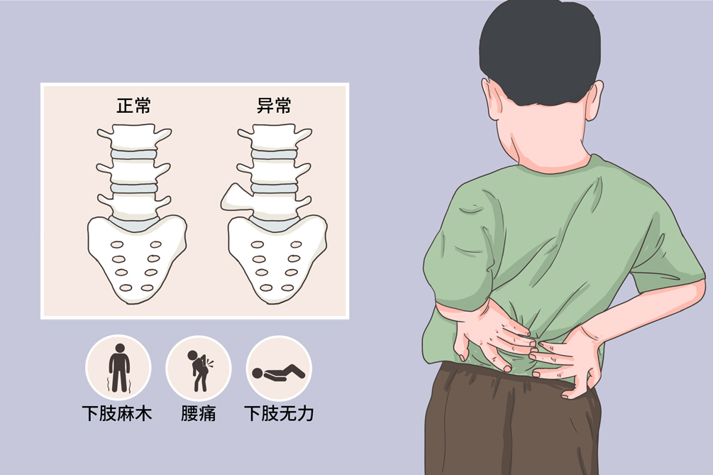 孩子一弯腰脊椎骨凸起明显