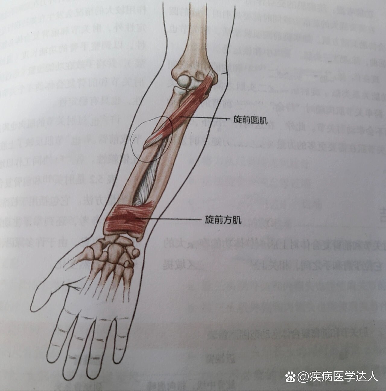 尺骨冠突肌肉附着图片