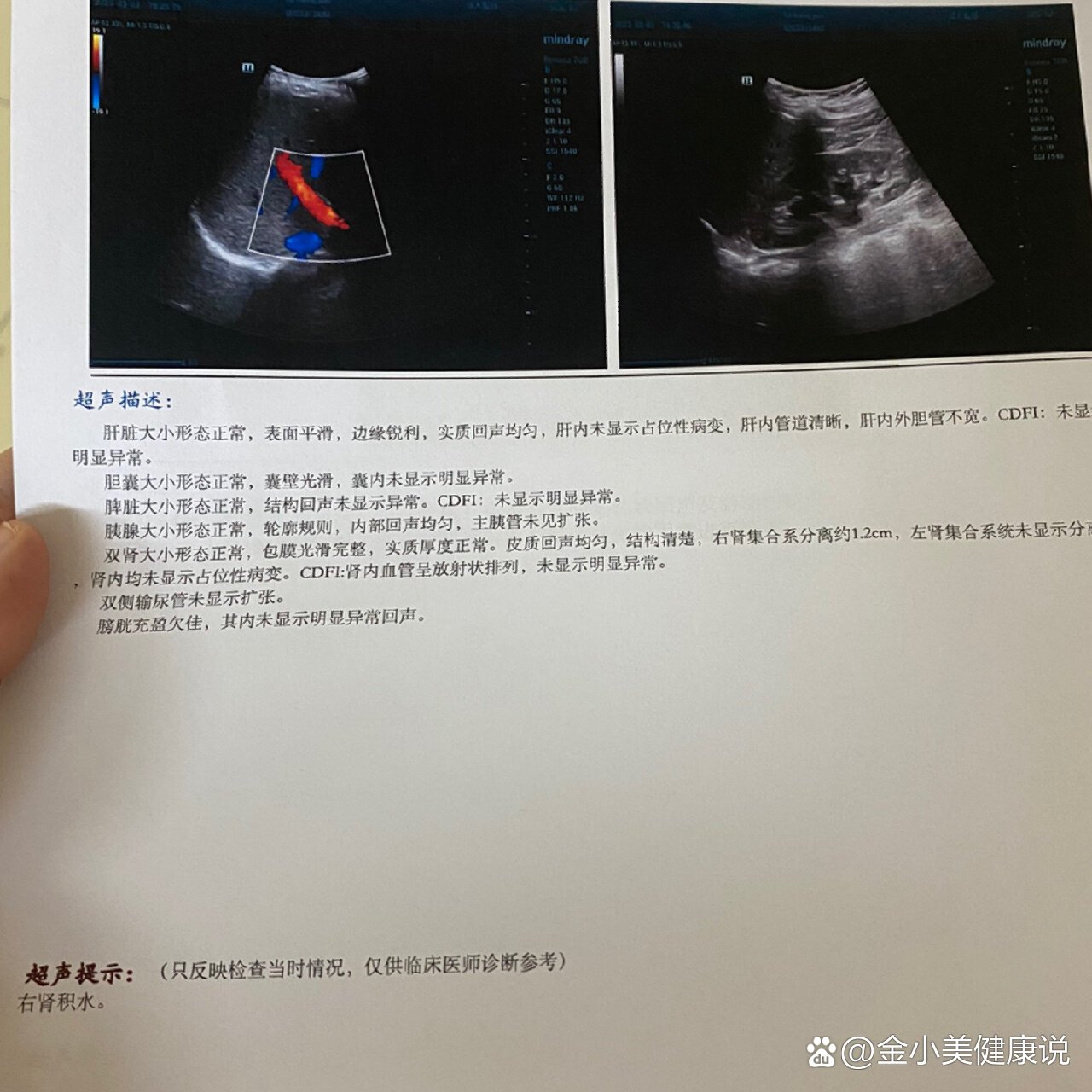 孕32周|右下腹牵扯疼痛到哭
