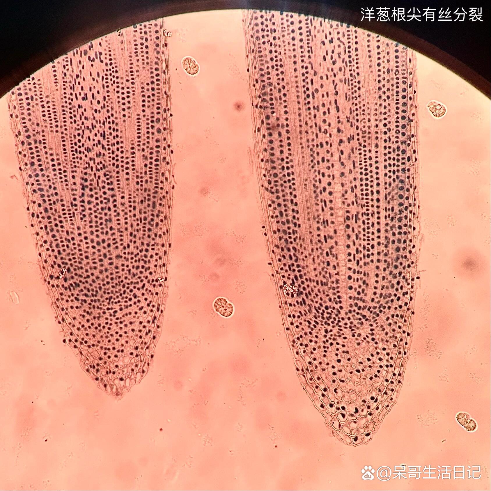 洋葱根尖纵切结构图图片