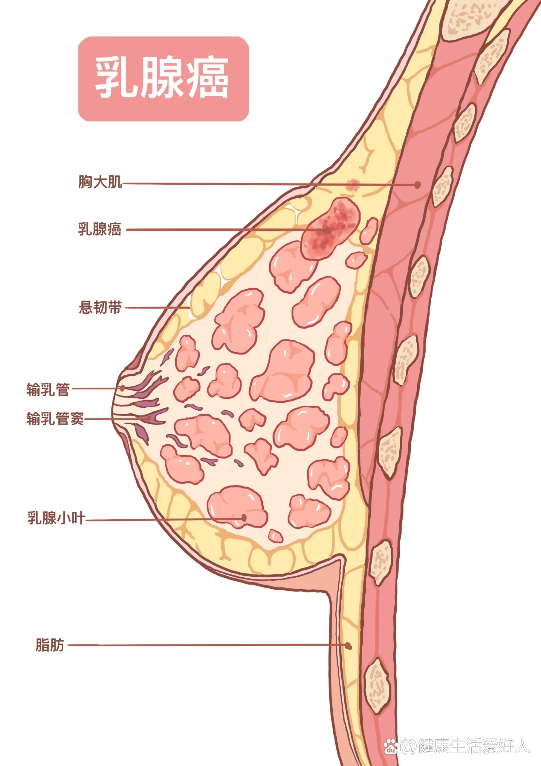 医学插画练习day7